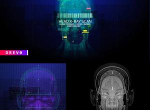 8组头部大脑X光扫描医疗HUD元素4K视频素材